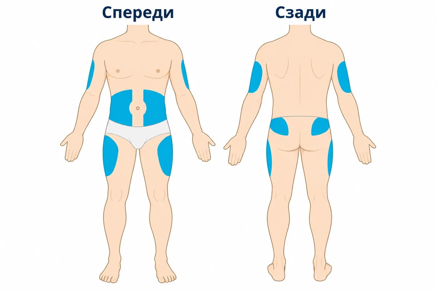 Вид спереди и сзади. Бирюзовым выделены живот с исключением пупка и средней линии, передненаружная часть бёдер, верхняя наружная часть ягодиц и задненаружная поверхность плеч